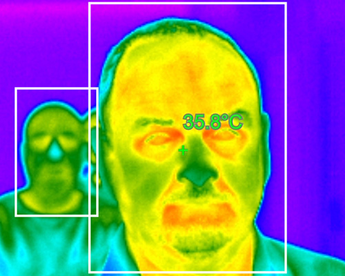 Temperature scanning a man's head
